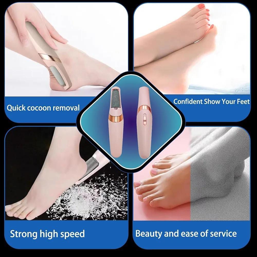 Electric Foot File Callus Remover